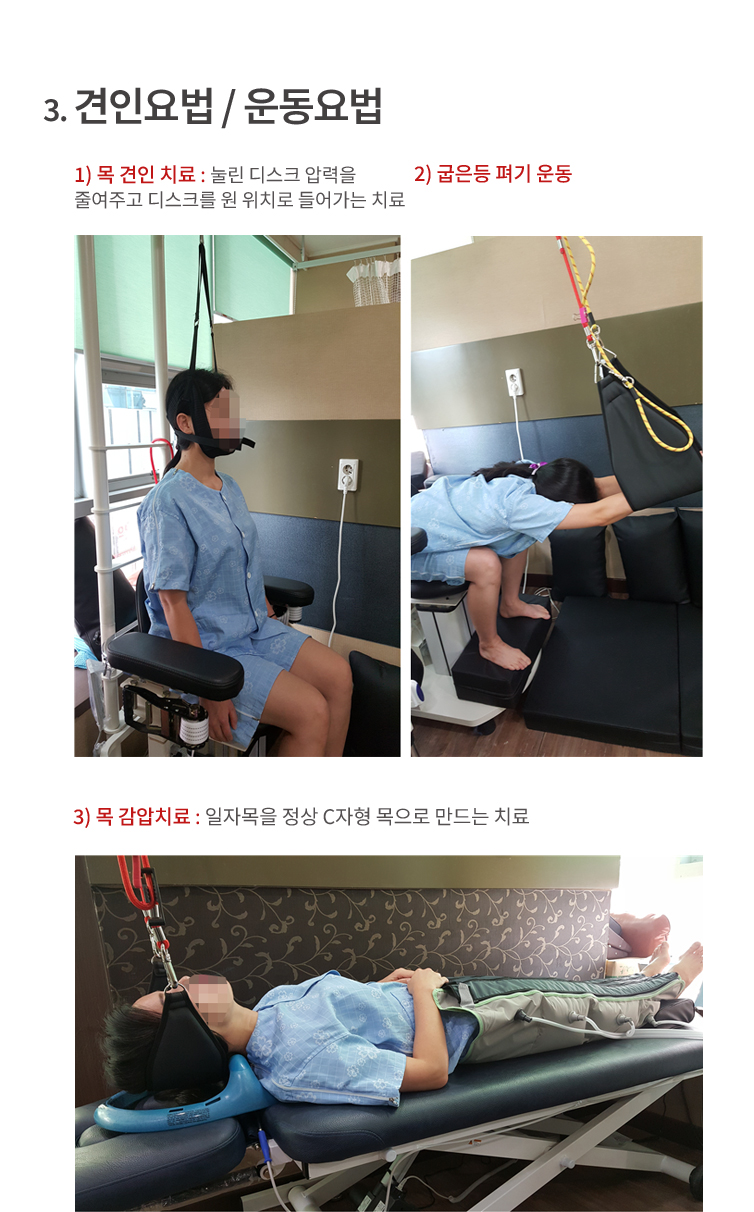 견인요법/운동요법