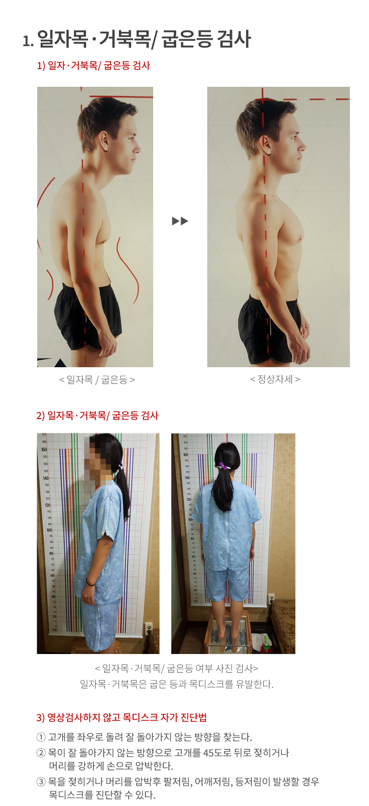 일자목,거북목/굽은등검사