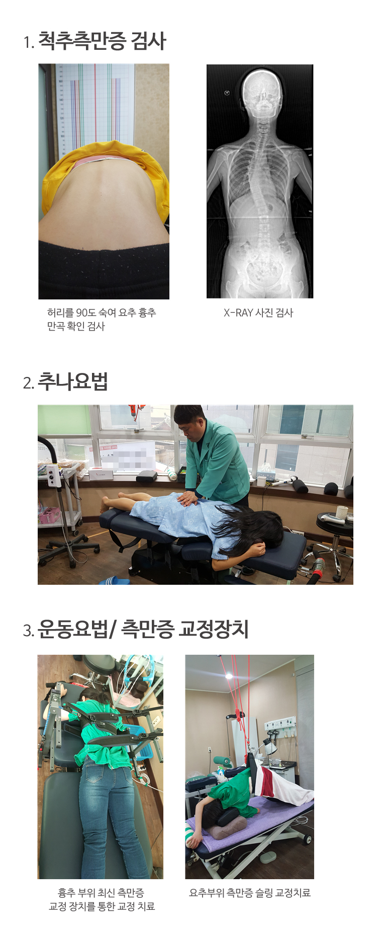 척추측만증검사