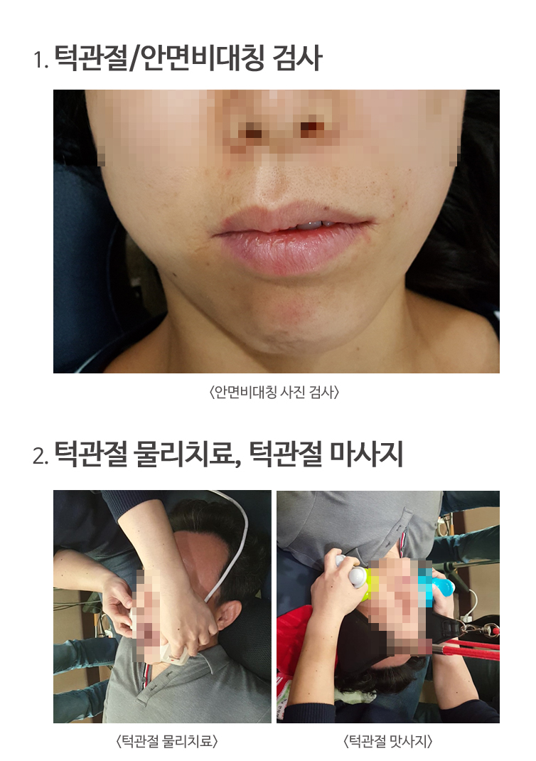 안면비대칭검사