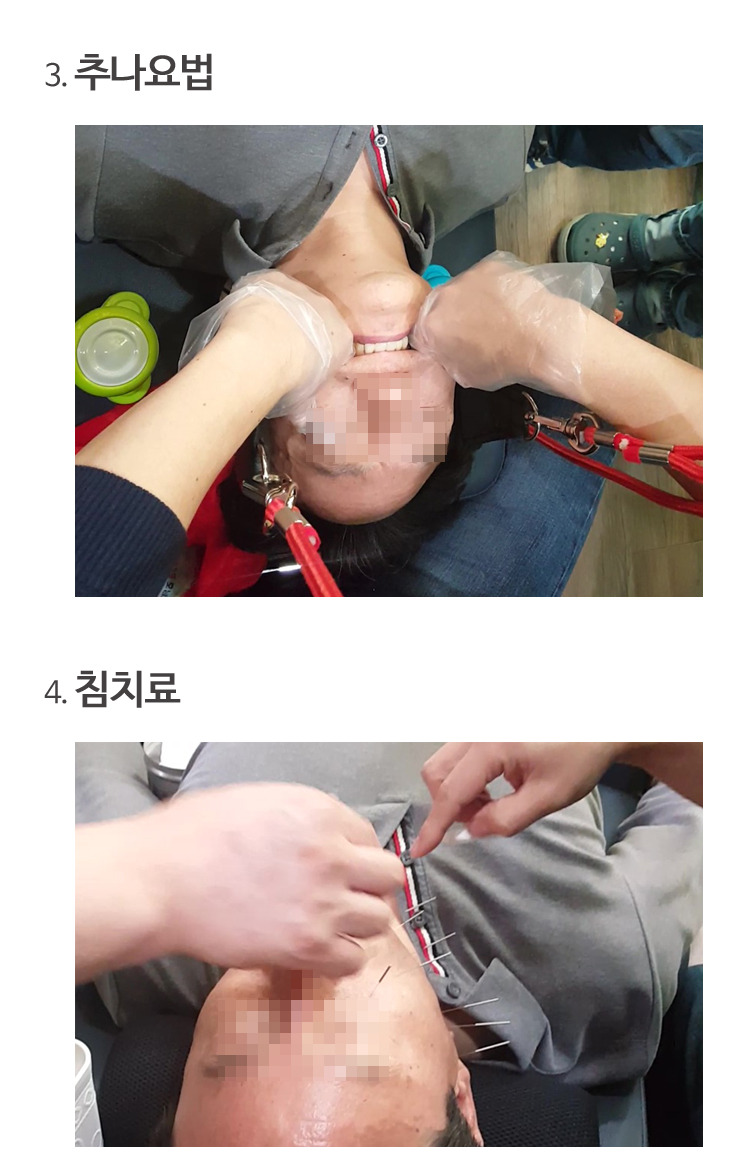 턱관절물리치료마사지