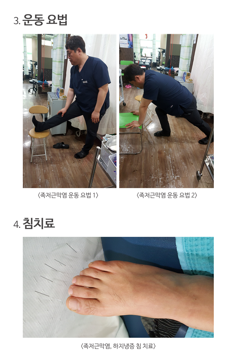 발바닥물리치료