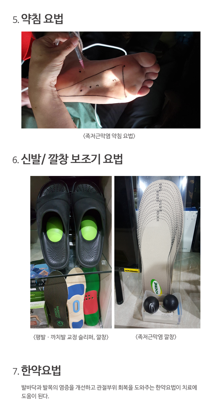 신발깔창보조기요법